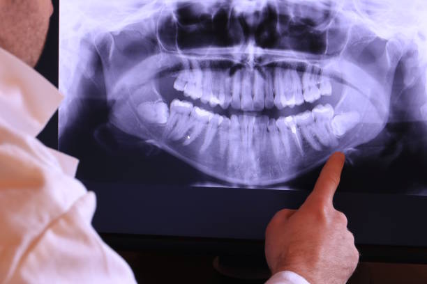 Best Same-Day Emergency Dentist in Bartlett, TX
