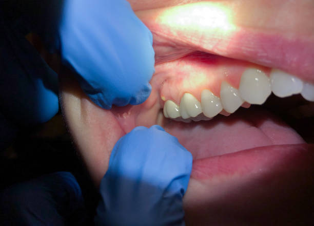 Best Pediatric Emergency Dentist in Bartlett, TX
